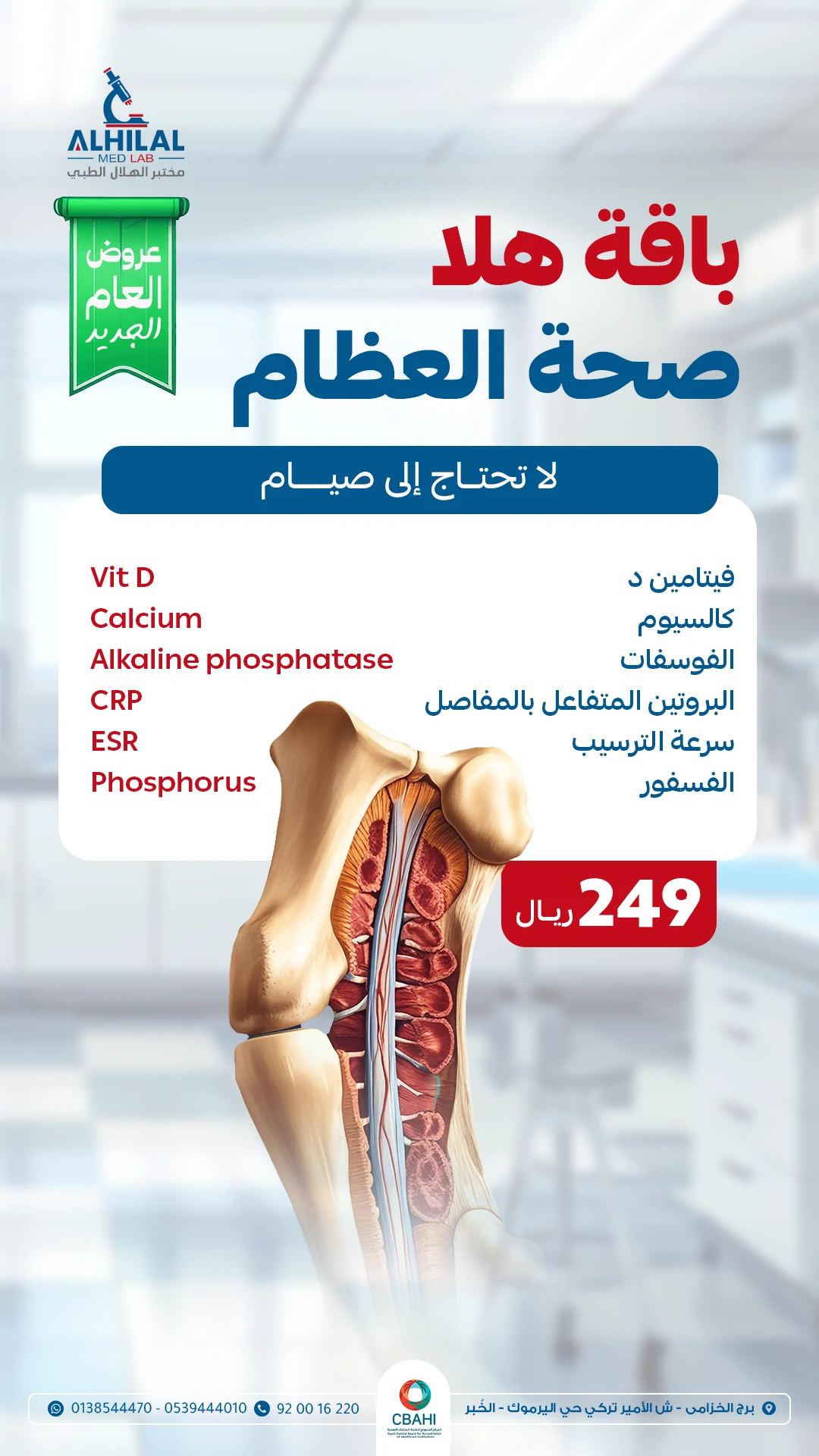 هلا صحة العظام