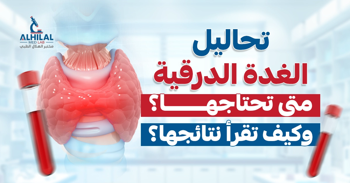 تحاليل الغدة الدرقية: متى تحتاجها؟ وكيف تقرأ نتائجها؟