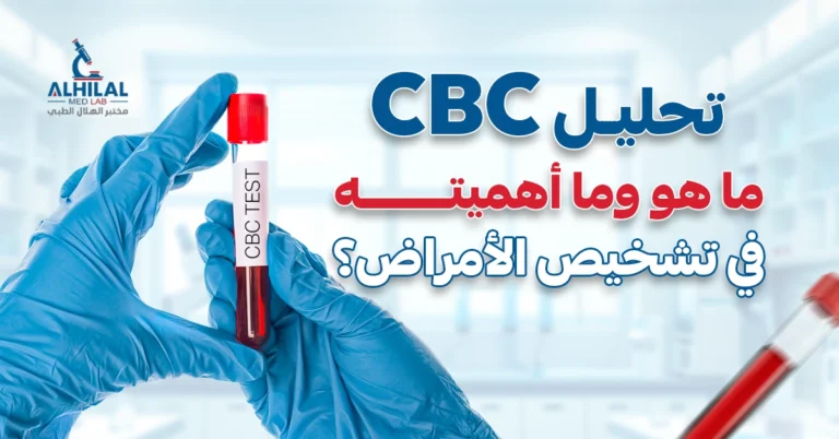 تحليل CBC: ما هو وما أهميته في تشخيص الأمراض