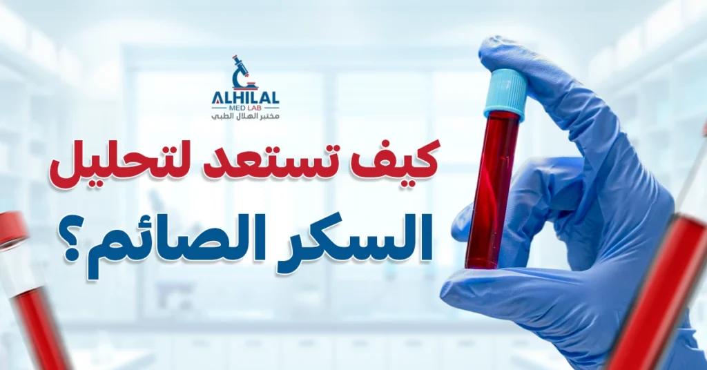 كيف تستعد لتحليل السكر الصائم؟