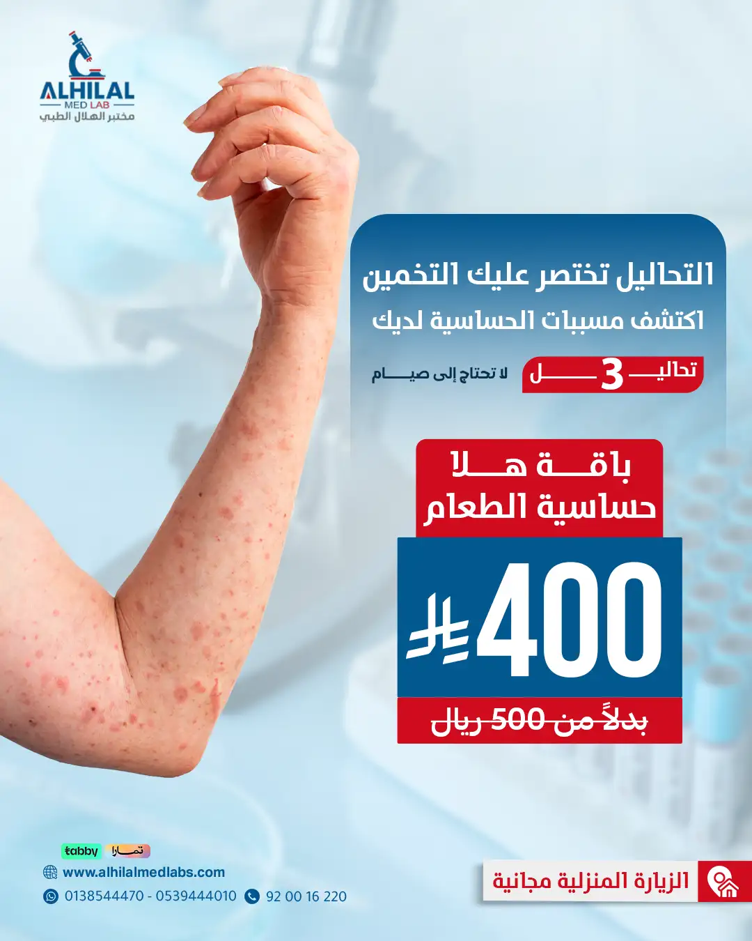 ⁠فحص حساسية الطعام