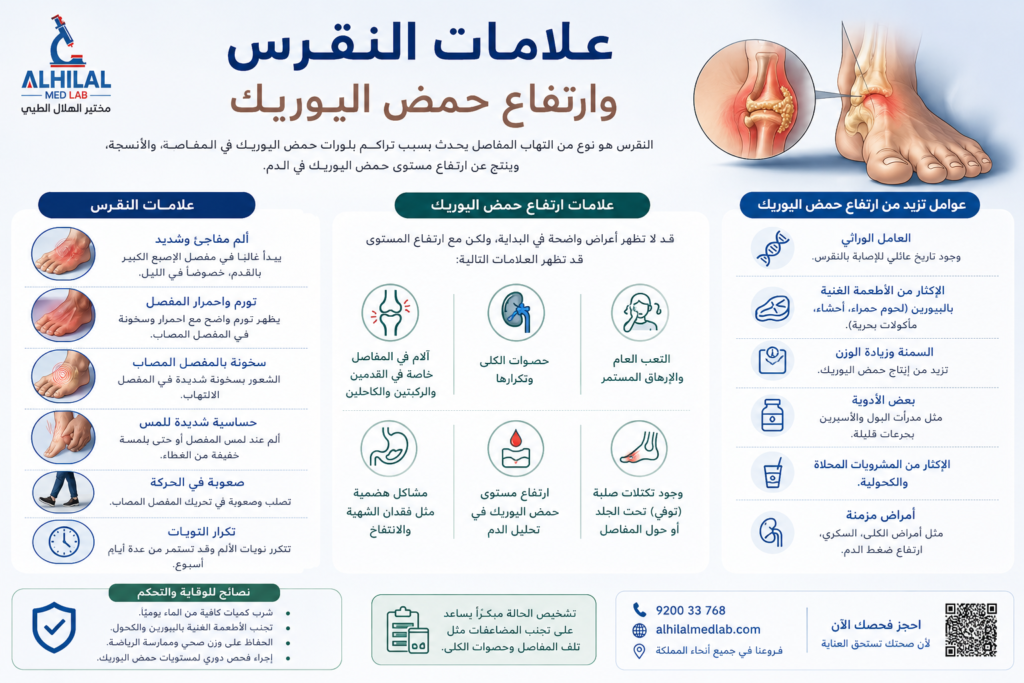 علامات النقرس وارتفاع حمض اليوريك - مختبر الهلال
