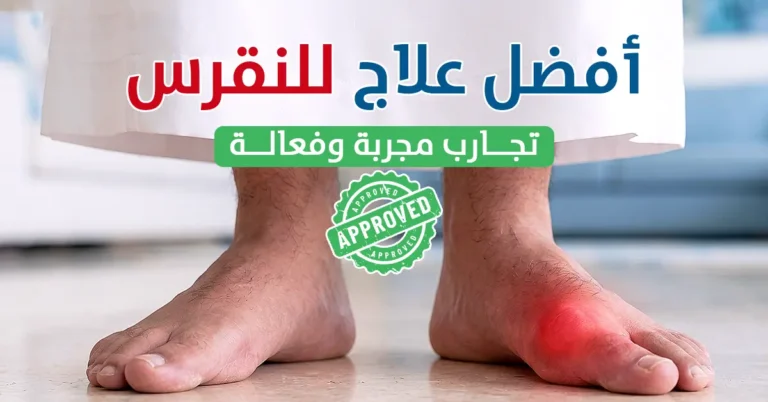 أفضل علاج للنقرس طرق مجربة وفعالة