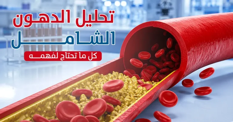 تحليل الدهون الشامل كل ما تحتاج معرفته عن ليبيد بانل - مختبر الهلال