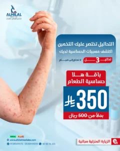باقة هلا حساسية الطعام