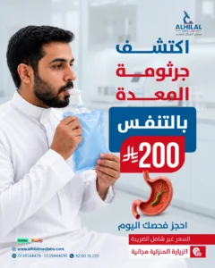 فحص جرثومة المعدة بالتنفس